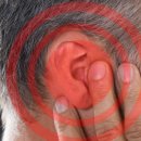 바른보청기 이미지