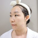 구리피부마사지 추천 라보떼 에스테틱 구리여드름피부관리 크리스티나 로즈필링 후기