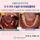 해남치과기공소 | 광산구치과 오스템 디지털가이드임플란트 우수식립 인증치과에서