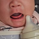 회진고려의원 | 제주 서정소아과 70일 아기 설소대 수술 후기, 시술후 관리 방법과 보험청구 정리