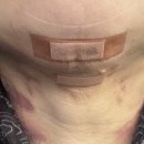 일미리성형외과의원 | 관리의 욕심은 끝이 없구나