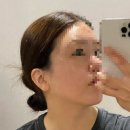 루트라인반포샵 | 반포윤곽관리 핫탄스파 후기 숨어있던 V라인 턱선 찾고 리프팅까지 확실하게