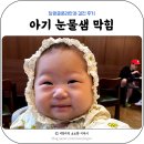 창원글로리안과의원 | 두 돌 아기 눈물 고임 눈물샘 막힘 (창원 글로리 안과 검진 후기)