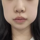 멍 클레어 이미지