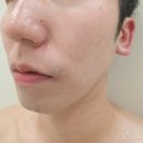 이랑바이오 | 평촌 피부관리 종결판! 에스떼제이 3일의 기적으로 환골탈태 모공 순삭 물광 피부 된 후기