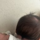 자연드림둔산점 | 대전 토리소아과 아토피 아기피부 100일아기 진료 후기