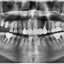 중앙치과기공소 이미지