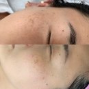 조앤의료기기 | 유일,국내최초!! 피부과 원리랑 같은 가정용홈케어기기!울트라토닝 디바이스!하루3분 4가지효과! 하나씩...