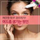 아름다운 이미지ㅡ여드름 생기는 원인 ㅡ 이미지