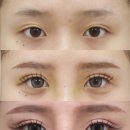 올리팅성형외과의원 이미지