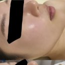 임소현 피부전문 연구소