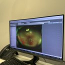 비스타안과의원 | 부산 해운대 비스타안과 검안 후기 (feat. 컨투라 라섹)