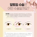 인더라인 이미지