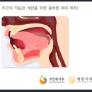 치아의 결손[치아의 상실 또는 발치된 경우, 치아 일부 결손 1/2개 결손으로 적용, 2018년 4월 1일 이후 보험계약] 이미지