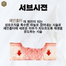 올뷰티의원대전유성 이미지