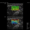 엠브이에스 이미지