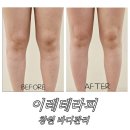 이레결혼정보 | [ 창원 에스테틱 ] 이레테라피(2) : 아율베다 하체 슬림 관리로 다리 붓기 싹 빼고 온 솔직 후기