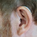 독일명품보청기 이미지