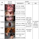 담배 경고 그림과 문구, 2년만에 교체 이미지