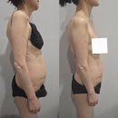 더 행복한 뷰티샵 | 양산 뷰티샵 김영주뷰티 부산 뱃살관리 제대로 빼고 온 내돈내산 후기
