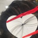 촘촘 스칼프 이미지