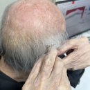 목동독일보청기 이미지