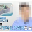 틀치과기공소 이미지