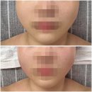 소망케어 | 시흥피부관리 &#34;윤스킨케어&#34;에서 &#39;근막케어&#39; 받고 온 후기!