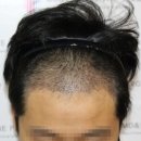 서울라인성형외과의원 이미지