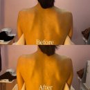 이마트24 첨단메디케어점 | 에스테틱 원장도 반한 첨단 레아쥬 등관리 맛집(In. 메디케어스킨&amp;바디)