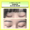 강남종합의료기 | 쌍꺼풀 수술은 어디서? 안과 말고 성형외과 후기가 왜 좋을까요?