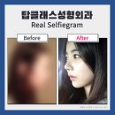 탑클래스성형외과의원 이미지