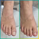 부전 | 서면 문제성발톱 핑풋 푸스케어 서면부전점 관리 후기~!!