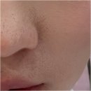 지실 | 보나메두사 프라이머 내돈내산 빡침주의 후기