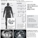 끈적해진 피, 모세혈관부터 막아서 온몸에 합병증 불러 이미지