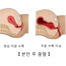 후의