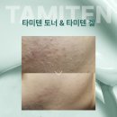 텐솔루션