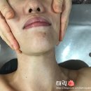리예에스테틱
