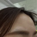 부평눈썹 아름답다허쉬 눈썹 잔흔제거 후기!