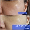 환절기 피부진정세럼 추천 민감성 피부도 편안했던 와이트리 듀이인앤포레세럼 후기