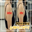 뉴페이스 | 라운드숄더 교정, 해운대 뉴페이스바디 솔직후기