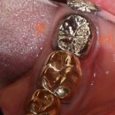 의정부본플란트치과의원 이미지