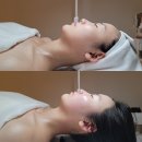델라루아 | 마곡 에스테틱 피부샵 델라루아 아프지않은리프팅윤곽관리 내돈내산 5회차 후기