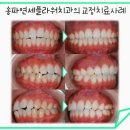 연세바른치과의원 이미지
