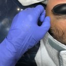 보람동_보람초등학교 앞 정류장 | [세종 초등학생 여드름관리] 이마 좁쌀·피지 정체 3회차 변화! 여학생 피부 실제 후기