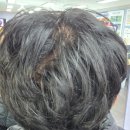 자혜로 | 부산 탈모성지 자혜내과의원 약복용 1달 후기