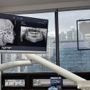 연세하이디치과의원 | 잠실새내치과 연세하이디치과 교정이 고민이라면