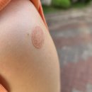 한우리치과의원 | 코로나 얀센백신 접종 완료(후기)! 고형기소아과의원에서(어제일기)