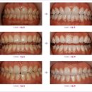 디에르치과의원 이미지
