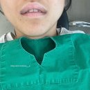 뽑고뽑기 | 매복 아래 사랑니 뽑고 온 후기, 뽑기전 할일, 가격, 통증 (feat. 내돈내산 신촌 잎사귀치과)